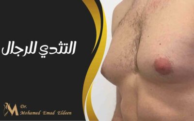 التثدي للرجال