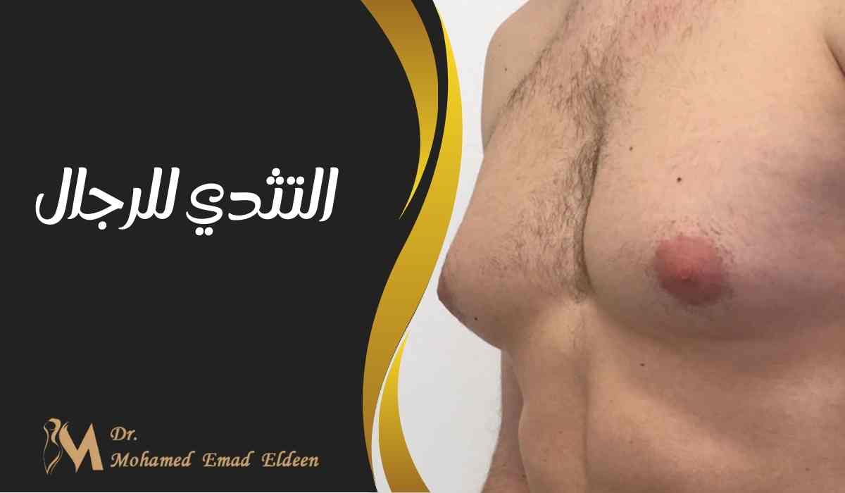 التثدي للرجال