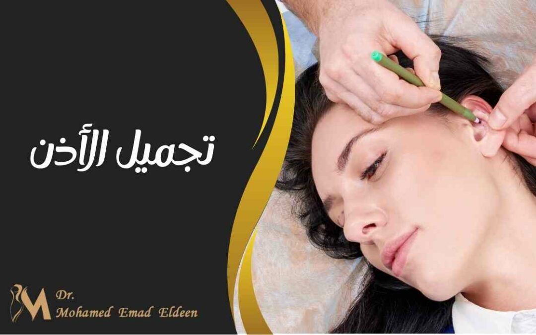 تجميل الأذن