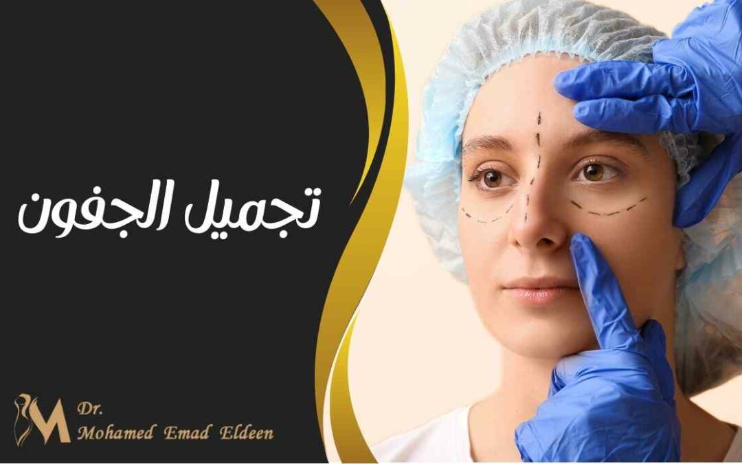 تجميل الجفون