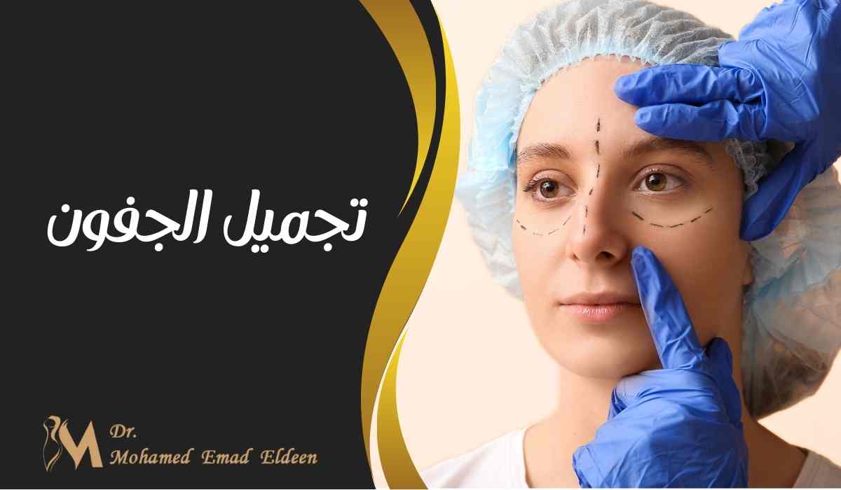 تجميل الجفون