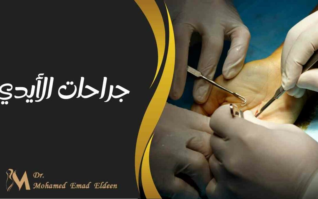 جراحات الأيدي