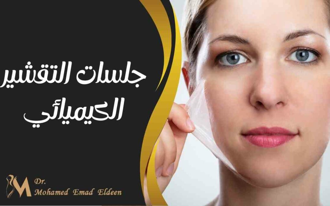 جلسات التقشير الكيميائي