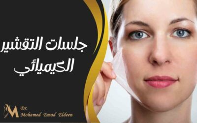 جلسات التقشير الكيميائي