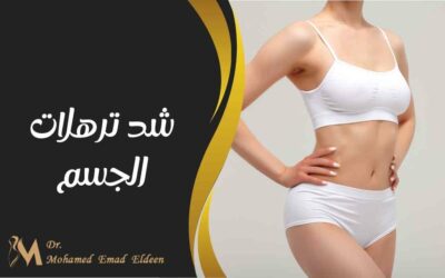 شد ترهلات الجسم