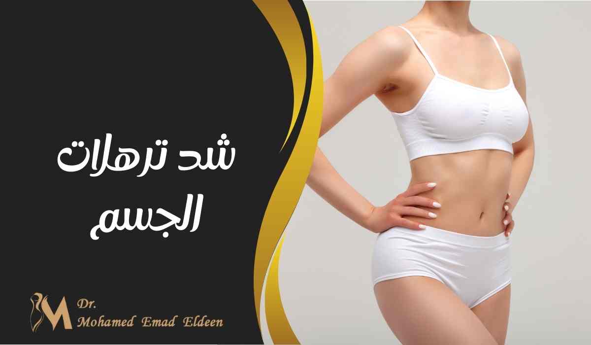 شد ترهلات الجسم