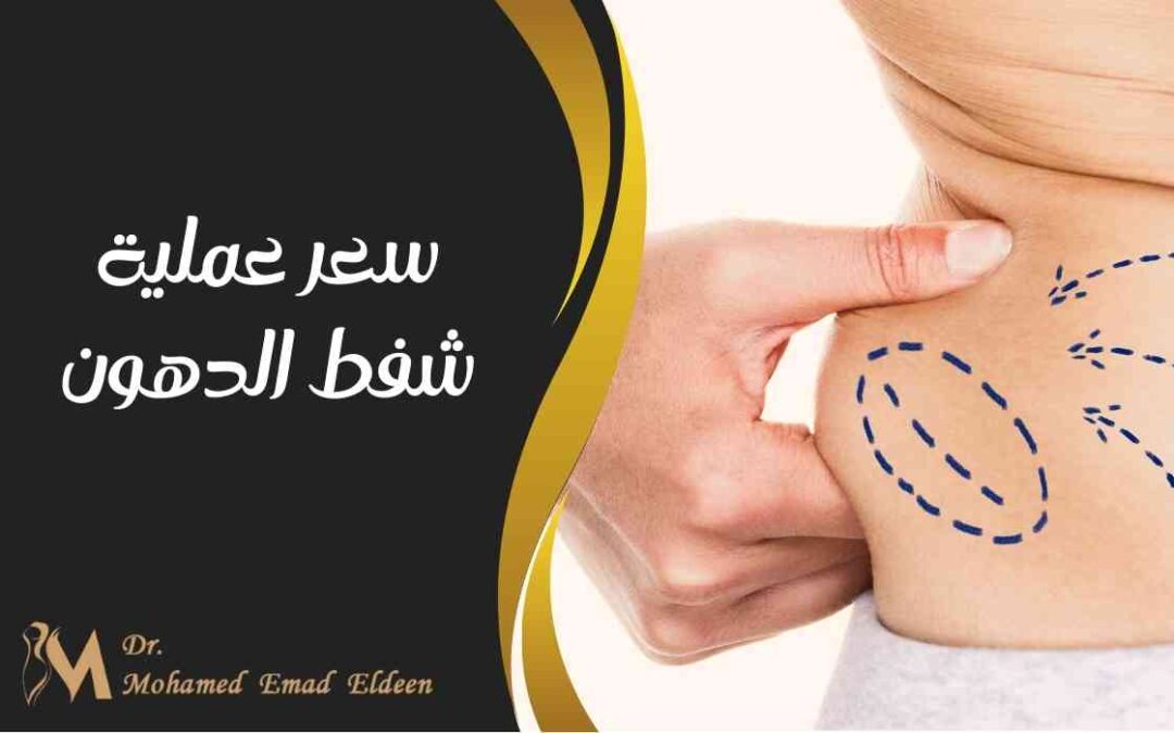 سعر عملية شفط الدهون