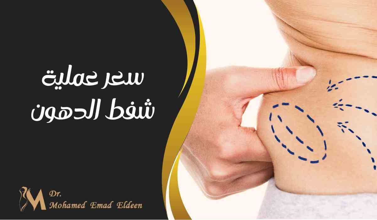 سعر عملية شفط الدهون