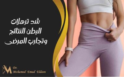 شد ترهلات البطن النتائج وتجارب المرضى