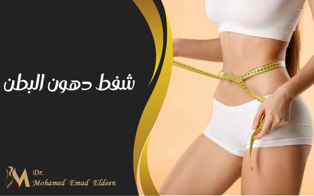 شفط دهون البطن