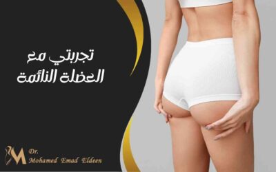 تجربتي مع العضلة النائمة
