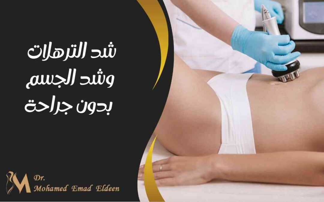 شد الترهلات وشد الجسم بدون جراحة