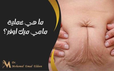 ما هي عملية مامي ميك اوفر؟