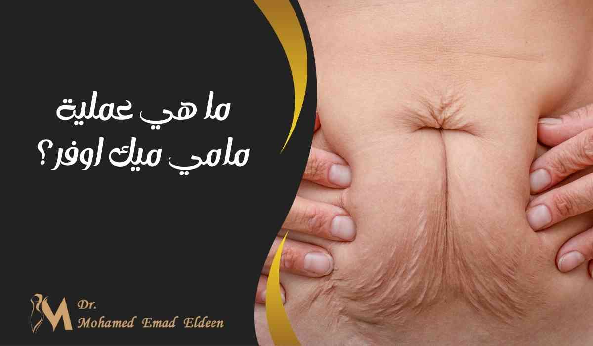 ما-هي-عملية-مامي-ميك-اوفر