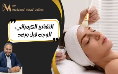التقشير الكيميائي للوجه قبل وبعد