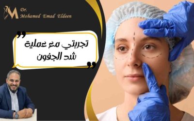 تجربتي مع عملية شد الجفون