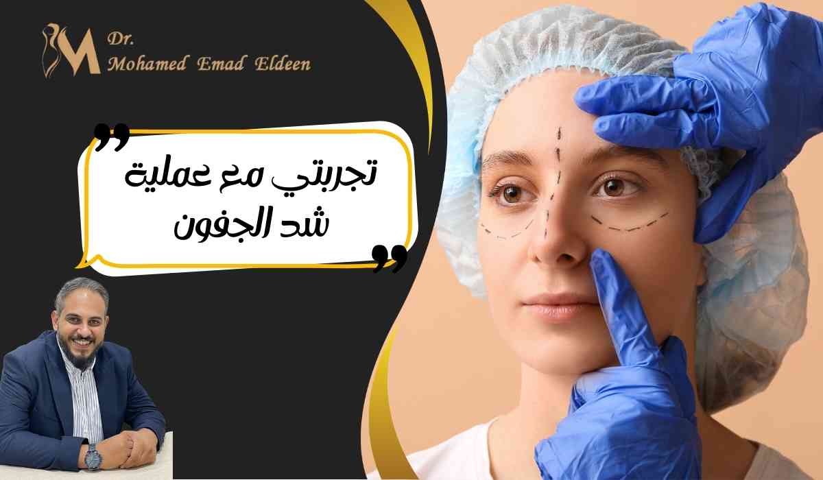 تجربتي-مع-عملية-شد-الجفون
