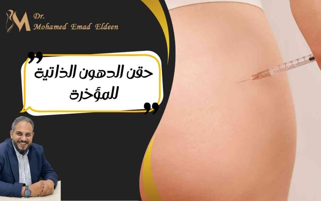حقن الدهون الذاتية للمؤخرة