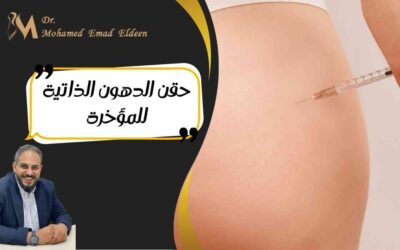 حقن الدهون الذاتية للمؤخرة
