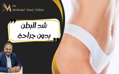شد البطن بدون جراحة