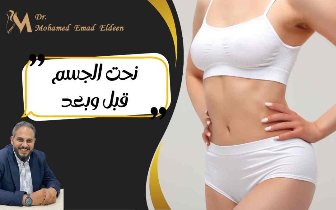 نحت الجسم قبل وبعد