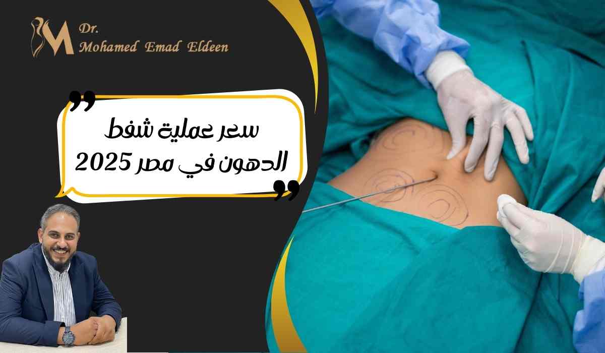 سعر-عملية-شفط-الدهون-في-مصر-2025