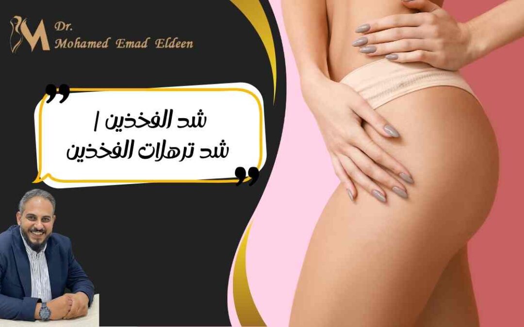 شد الفخذين | شد ترهلات الفخذين