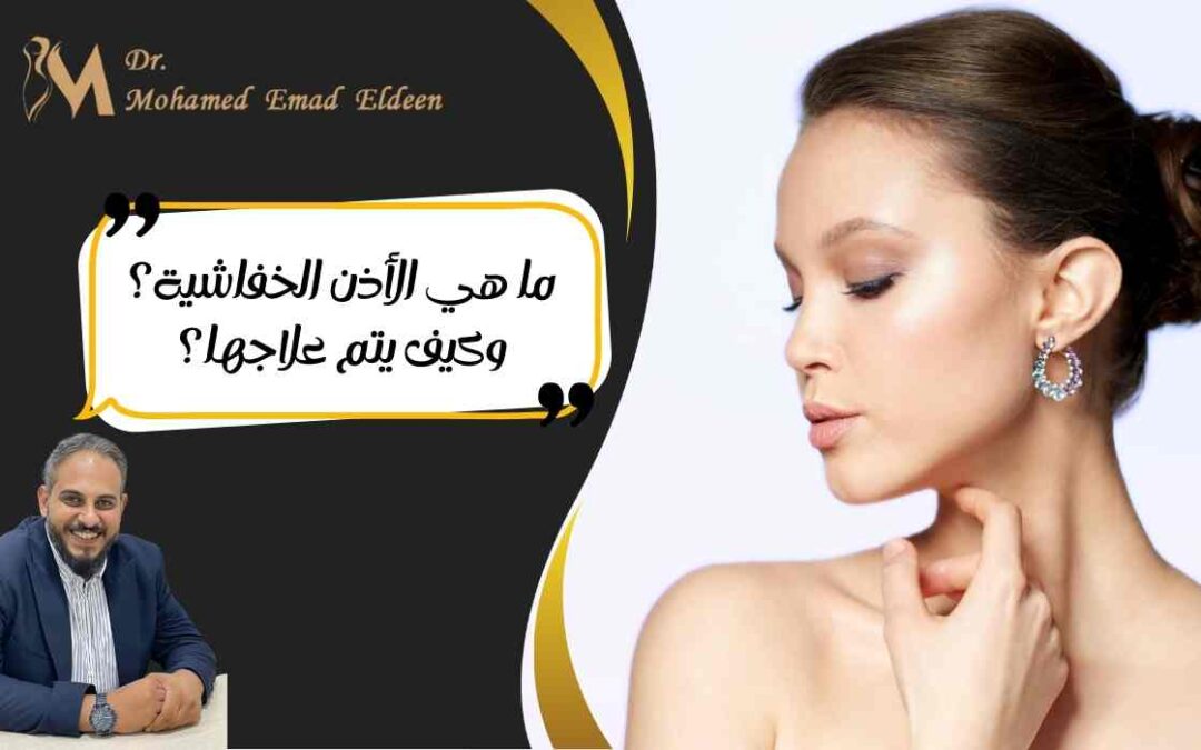 ما هي الأذن الخفاشية؟ وكيف يتم علاجها؟