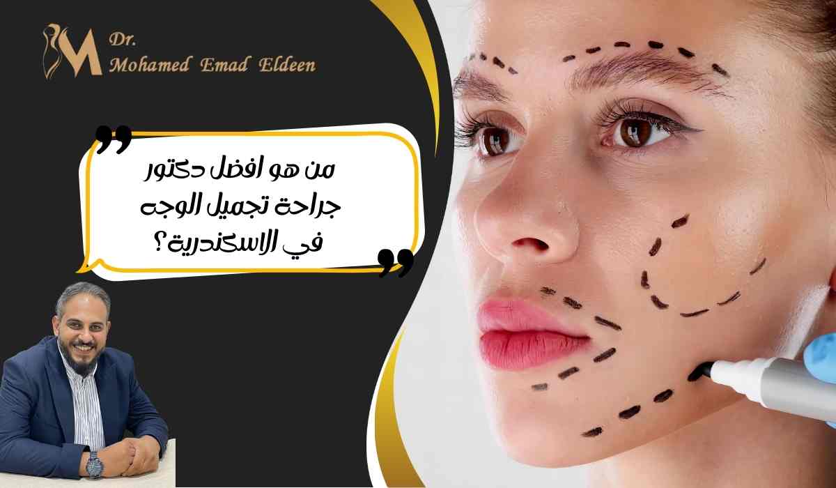 من-هو-افضل-دكتور-جراحة-تجميل-الوجه-في-الاسكندرية