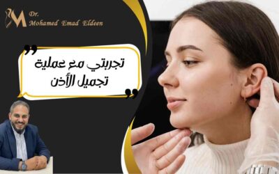 تجربتي مع عملية تجميل الأذن