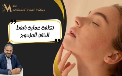 تكلفة عملية شفط الذقن المزدوج