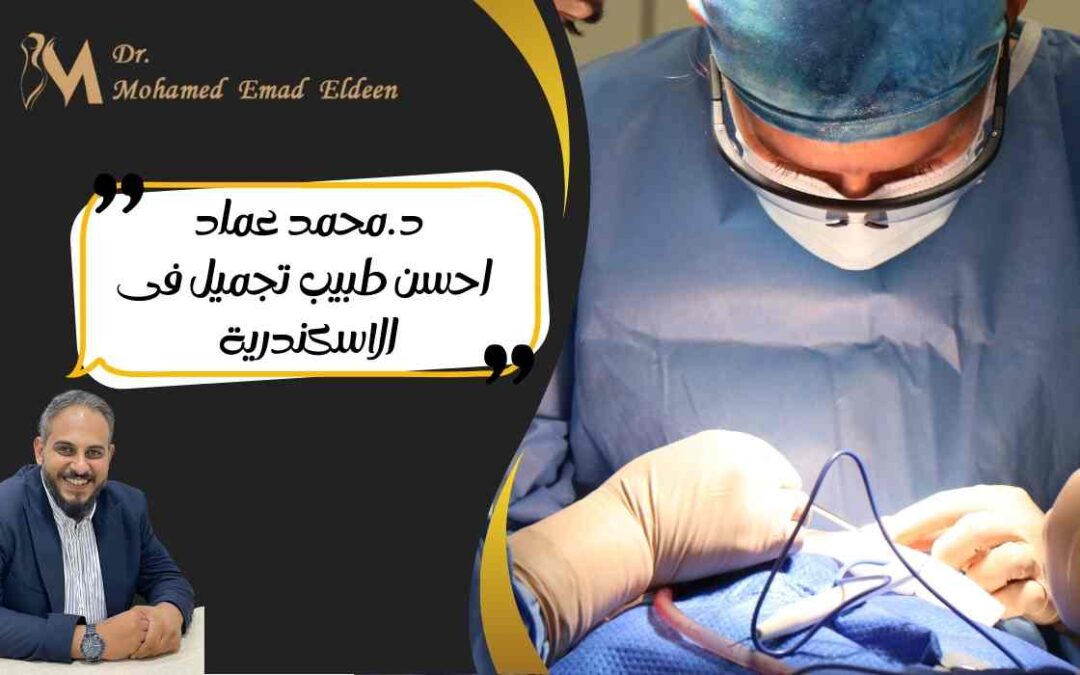 د.محمد عماد احسن طبيب تجميل في الاسكندرية