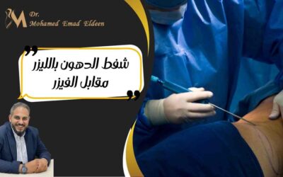 شفط الدهون بالليزر مقابل الفيزر