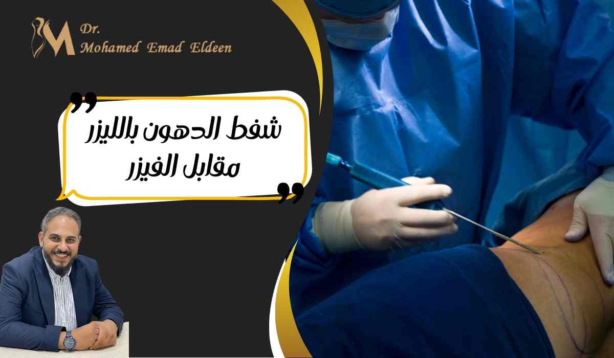 شفط-الدهون-بالليزر-مقابل-الفيزر