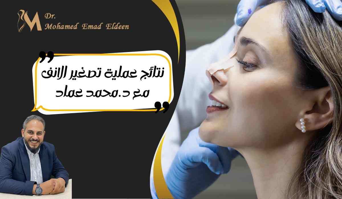 نتائج-عملية-تصغير-الانف-مع-د-محمد-عماد