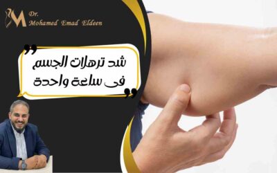 شد ترهلات الجسم فى ساعة واحدة