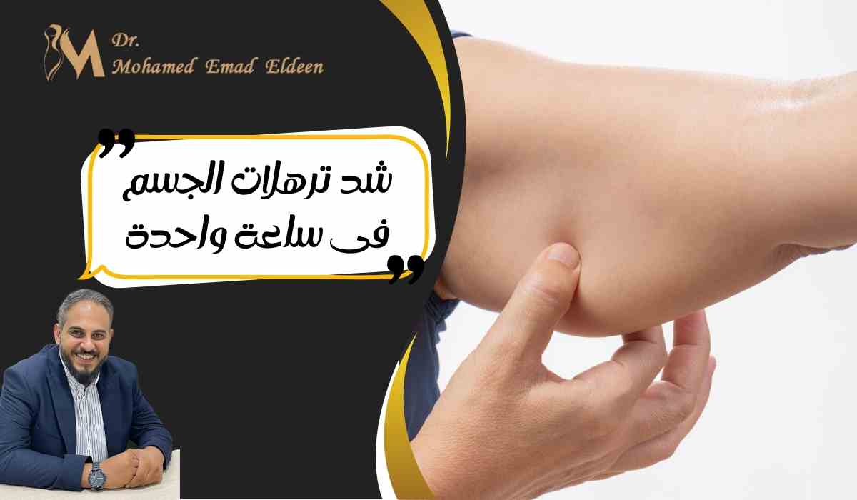 شد-الترهلات-فى-ساعة-واحدة