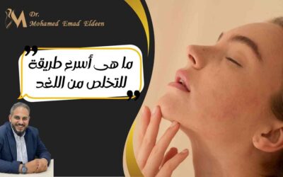 ما هى أسرع طريقة للتخلص من اللغد