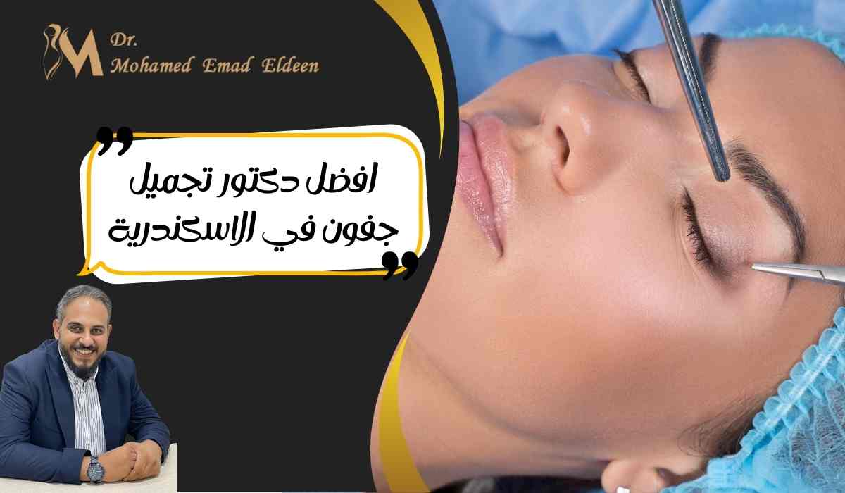 افضل-دكتور-تجميل-جفون-في-الاسكندرية