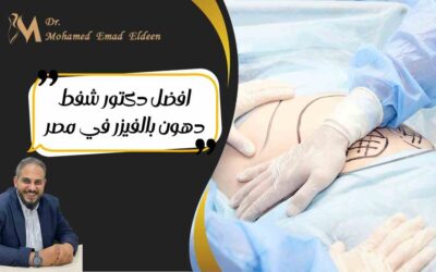 افضل دكتور شفط دهون بالفيزر في مصر