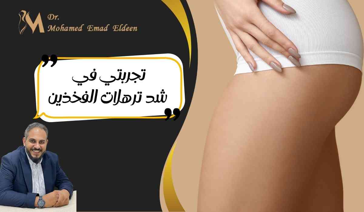 تجربتي-في-شد-ترهلات-الفخذين
