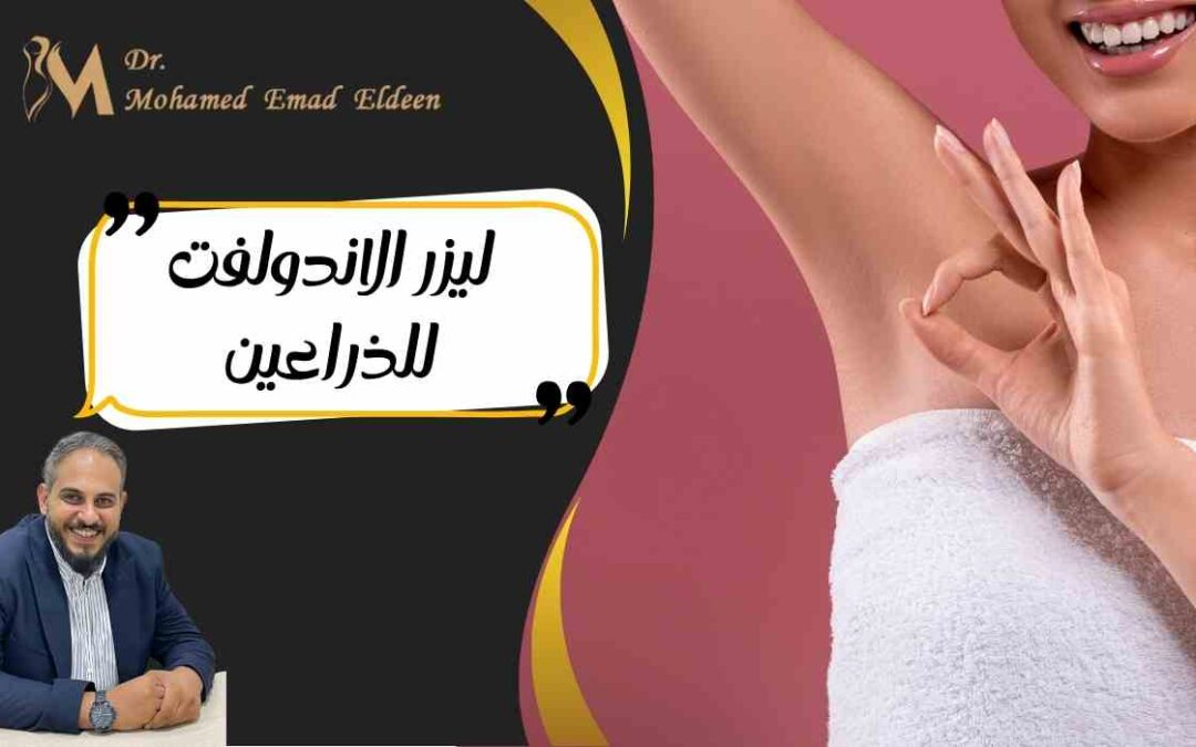 ليزر الاندولفت للذراعين