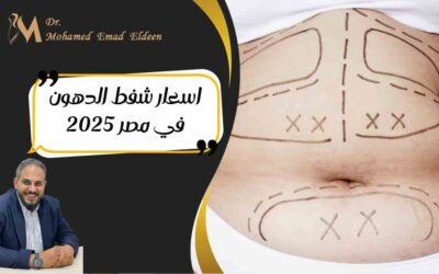 اسعار شفط الدهون في مصر 2025