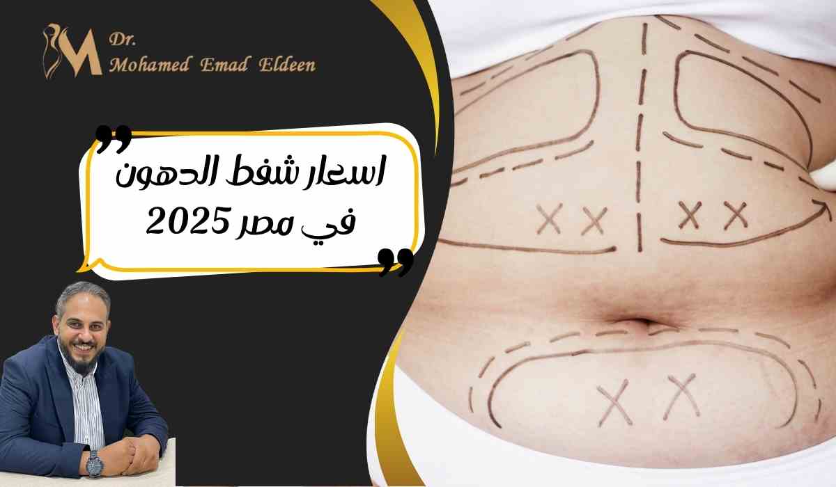 اسعار-شفط-الدهون-في-مصر-2025