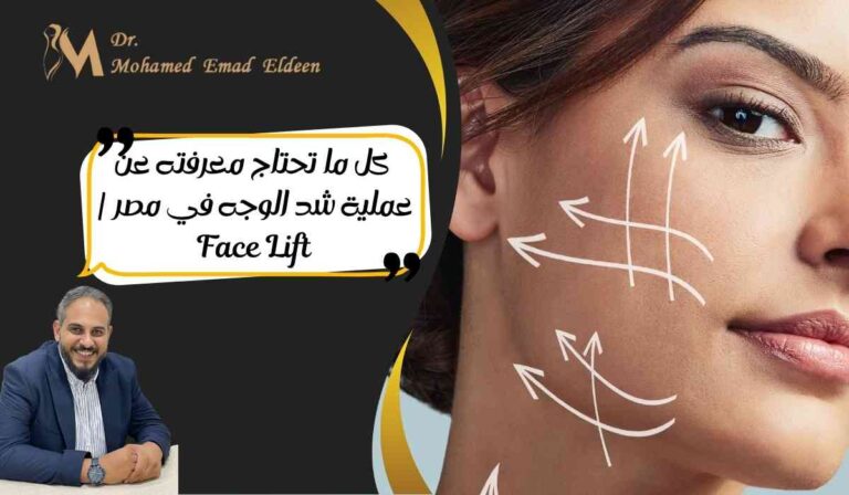تعرف على عملية شد الوجه مصر | د. محمد عماد