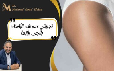 تجربتي مع شد الأفخاذ بالجي بلازما
