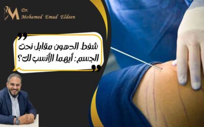 شفط الدهون مقابل نحت الجسم: أيهما الأنسب لك؟