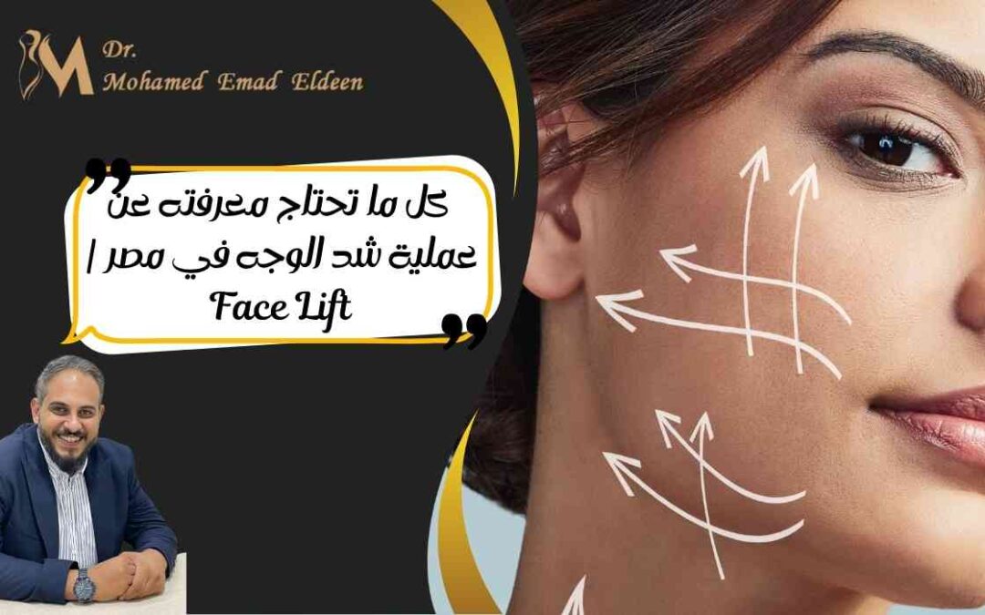 كل ما تحتاج معرفته عن عملية شد الوجه في مصر | Face Lift