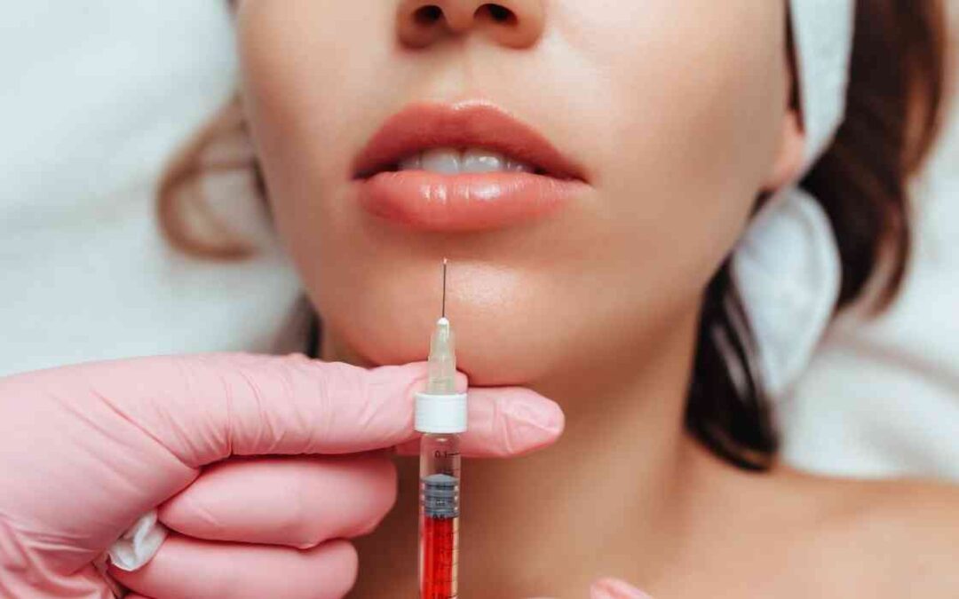 ما هو الفيلر الروسي للشفايف؟ وهل يناسب كل الأشكال؟