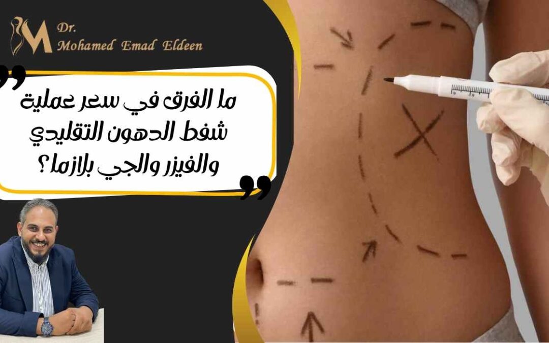 ما الفرق في سعر عملية شفط الدهون التقليدي والفيزر والجي بلازما؟